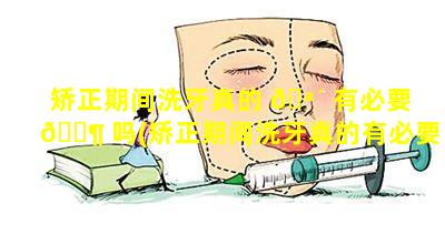 矫正期间洗牙真的 🪴 有必要 🐶 吗(矫正期间洗牙真的有必要吗知乎)